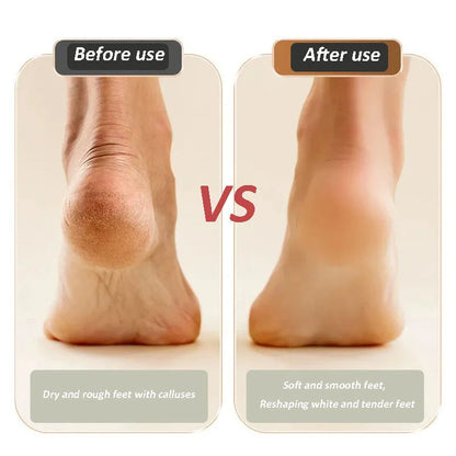 🔥Produit phare🔥Appareil de rajeunissement et de resurfaçage des pieds rechargeable par USB – Obtenez des pieds lisses et doux à tout moment, n’importe où ! 🦶✨
